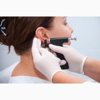 Проколювання мочки вуха з установкою стерильної сережки